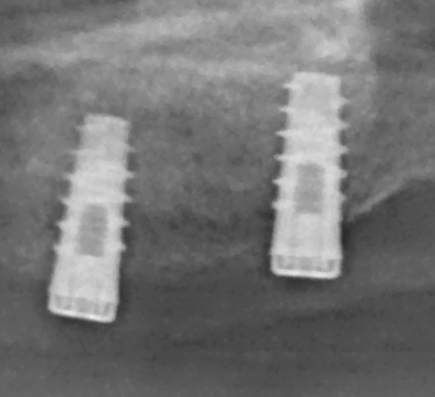 Fig. 23