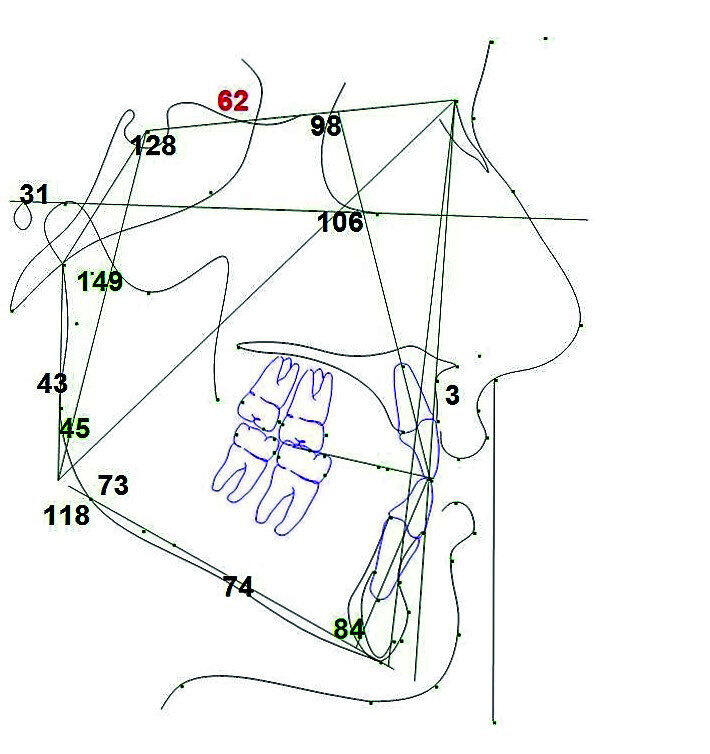 Fig. 17