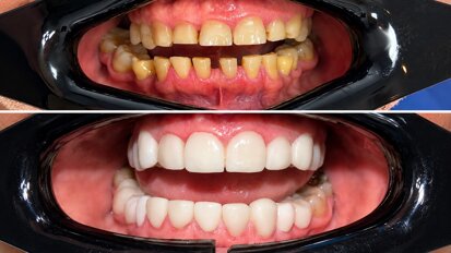 El paciente quería una sonrisa, pero el diagnóstico reveló algo más