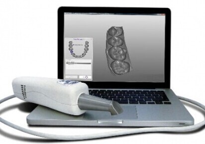 Scanner intraorale DENTICA 3D
