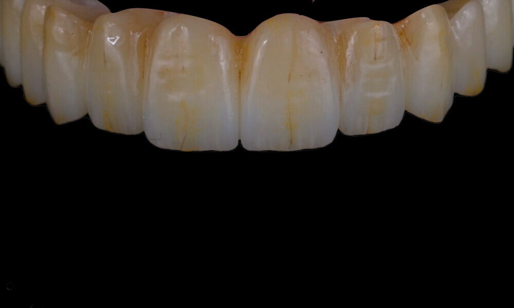 Fig. 48