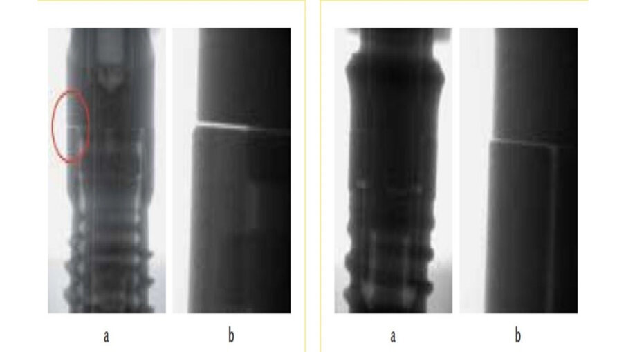 Obr. 4a–d: Detailní snímky dvou spojení implantátu a abutmentu při  zatížení žvýkacím tlakem.
