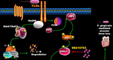 Scientist discovers mechanism to reduce inflammation and subsequent bone loss related to gum disease