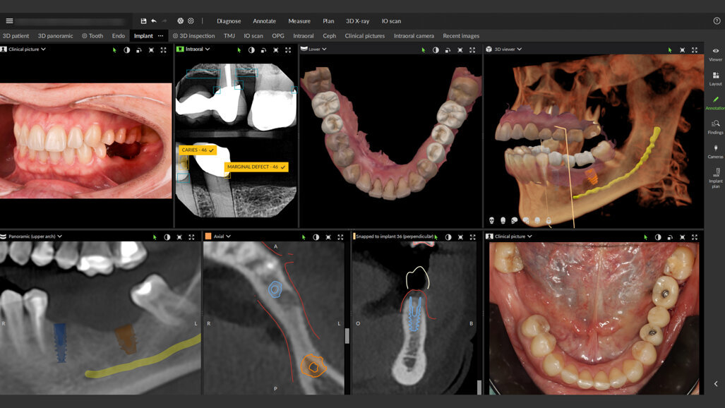 DEXIS lancia la nuova release di DTX Studio Clinic