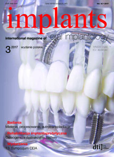 implants Poland No. 3, 2017