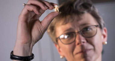 First permanent molars function as health database dating back to before birth