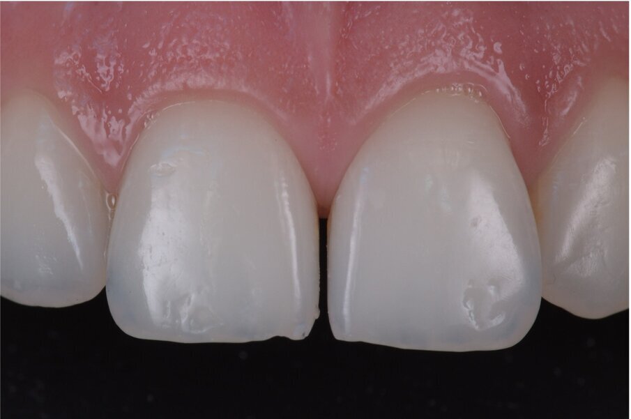 Case 2, Fig. 1.