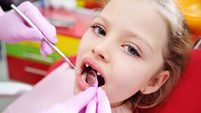Study identifies new bacterial species involved in dental caries formation