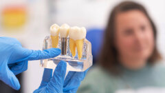 Novi prognostički model poboljšava petogodišnju procjenu uspješnosti implantata