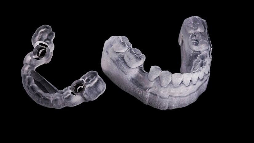Digitalisation of the gold standard of implantology