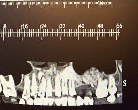 Fig. 19
