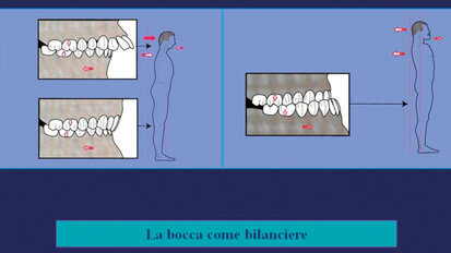 Bocca e assetto posturale: l’evoluzione della specie e dell’individuo vi passa attraverso
