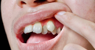 China emerging as key orthodontics and clear aligner market