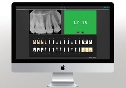 DEXIS Mac software