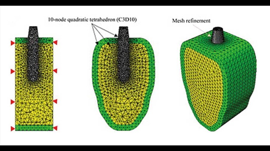 Fig. 9_A sinistra con i triangoli rossi vengono indicati i vincoli inseriti sul modello FEM.