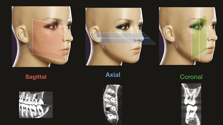 Figg. 4a-4c - La CBCT offre la possibilità di fornire e immagazzinare immagini radiografiche leggibili su vari piani sia orizzontali che verticali: assiale, sagittale e coronale.