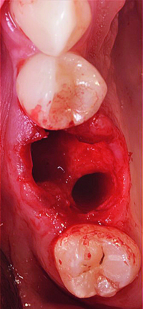 Fig. 4b