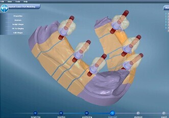 DentalCAD