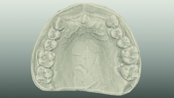 Materials and systems for all ceramic CAD/CAM restorations
