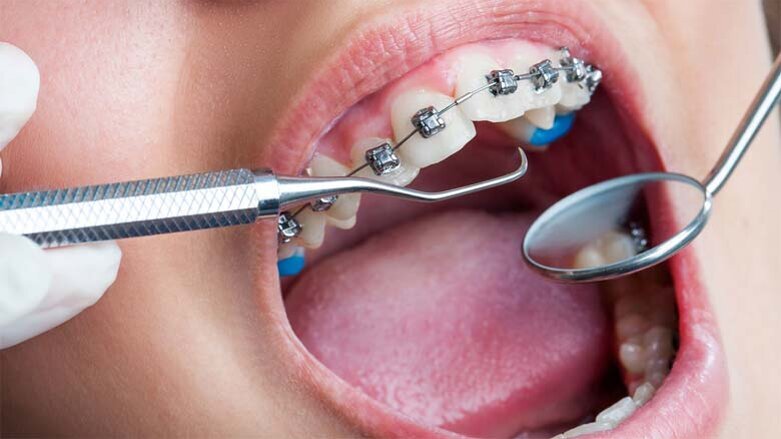 Online Event Emphasises On ‘Primary Healthcare & Practice Of Dentistry’