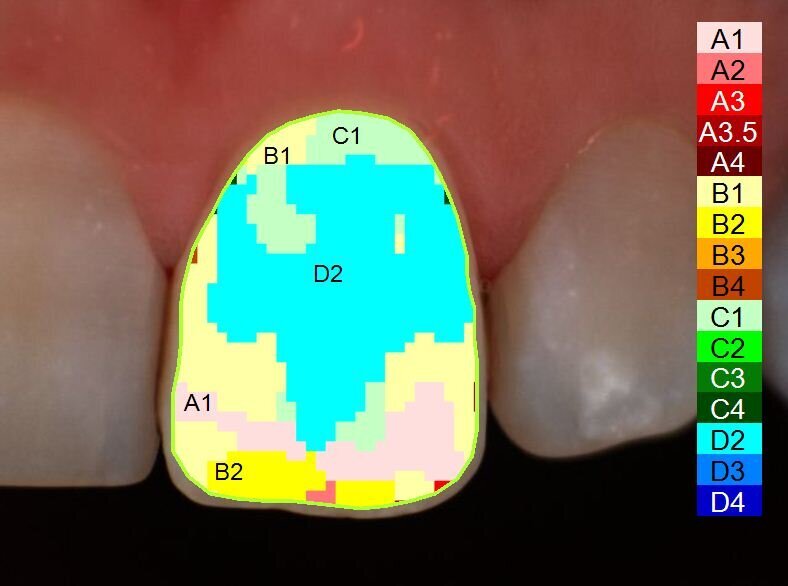Fig. 3c