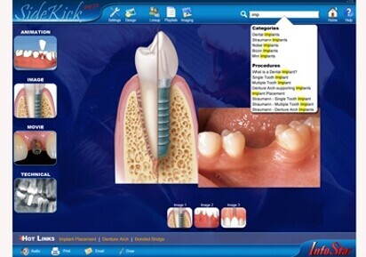 Custom multi-platform patient education software