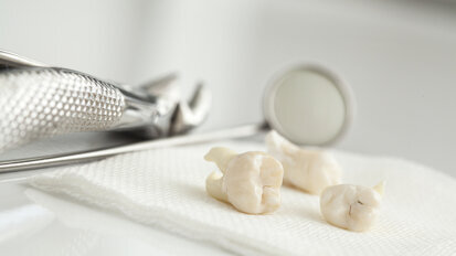 Indian dentists extract 526 teeth from boy’s mouth