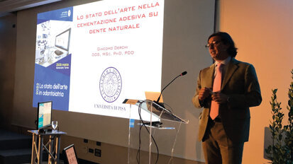 La cementazione adesiva su dente naturale: Intervista al prof. Giacomo Derchi