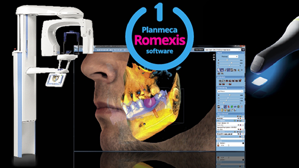 La combinación perfecta: CAD/CAM y CBCT 3D en un software