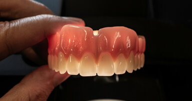 Researchers target tuneable denture materials for next-generation prostheses