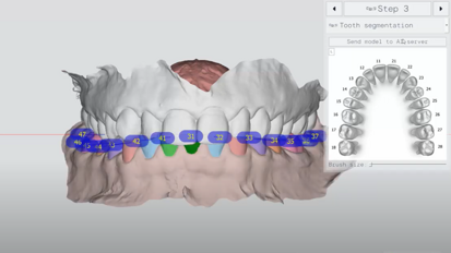 Polorto – DDP AI – Digital diagnostic model in just a few minutes with Artificial Intelligence.