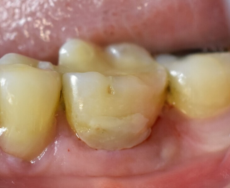 Fig. 4