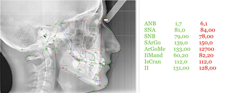 Fig. 13