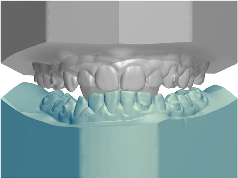 Fig. 2b