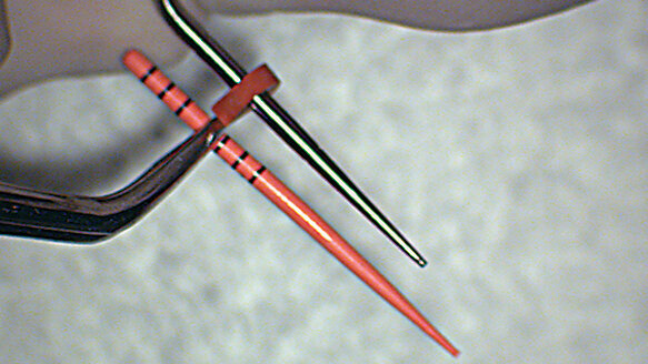 The continuous wave of obturation technique for enhanced precision