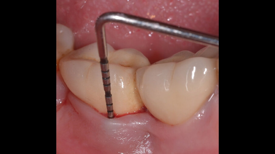 Fig. 1b