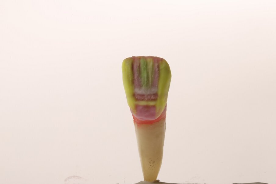 Fig. 14a: Layering with GC Initial LiSi.