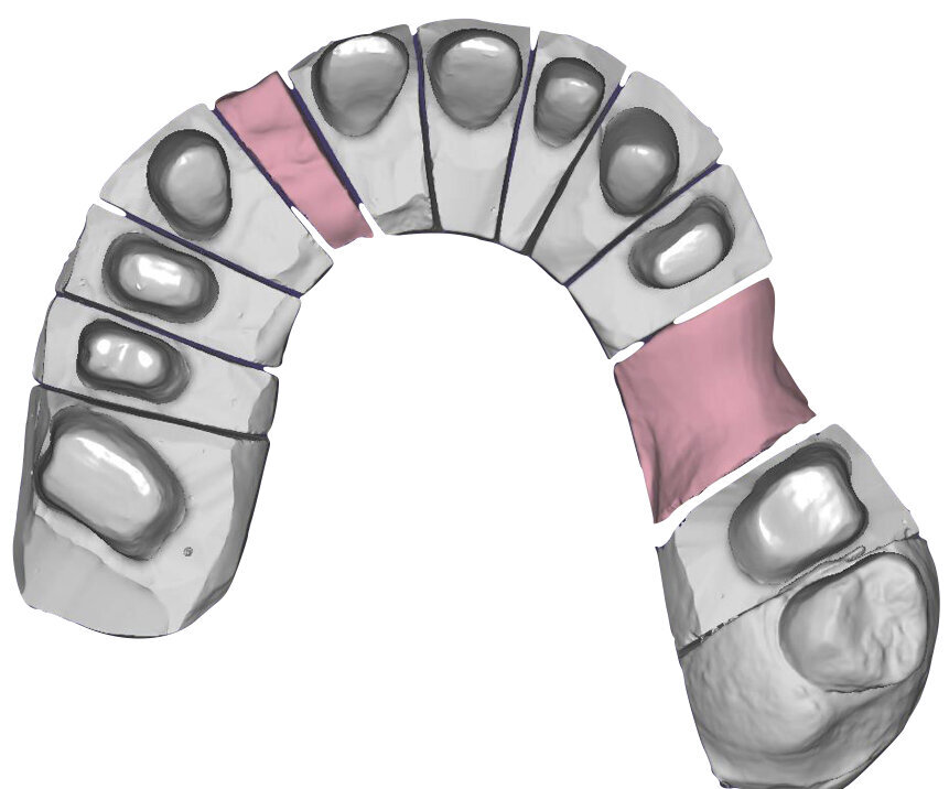 Fig. 47