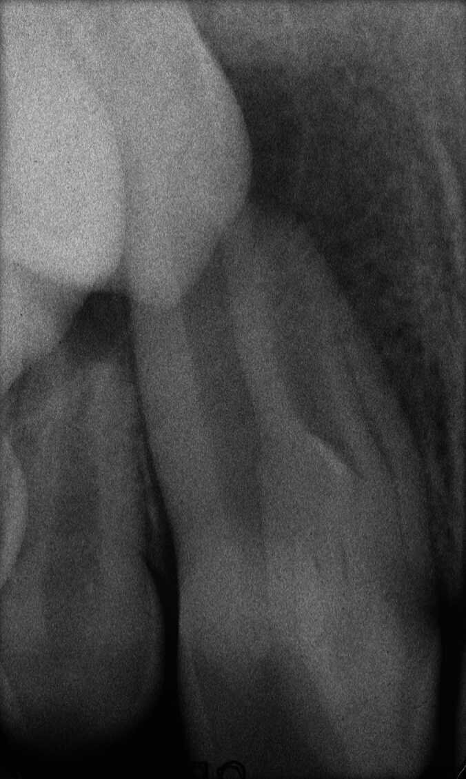 Figure 32