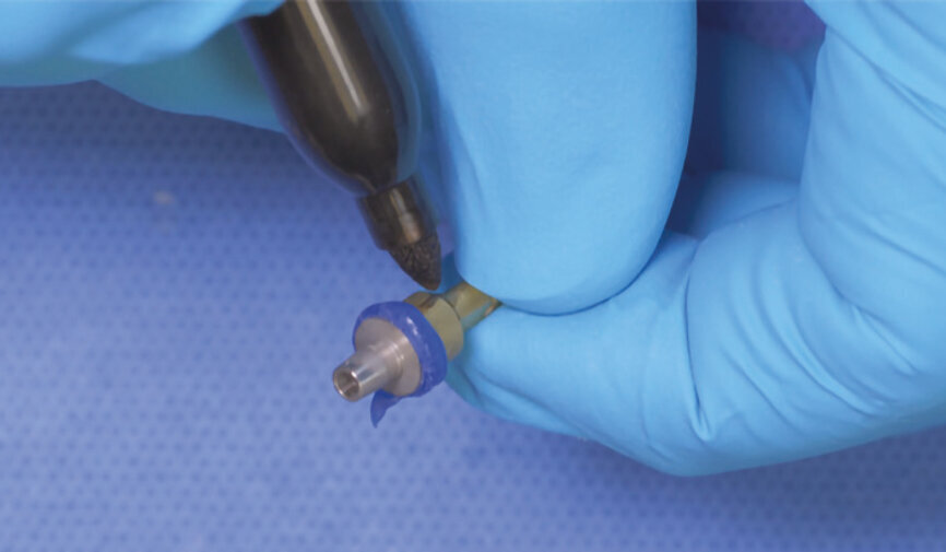 Fig. 5: Mark the index position (notch) on the implant analogue. 