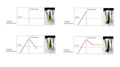 Pourquoi certaines lésions endodontiques guérissent et d’autres pas ?