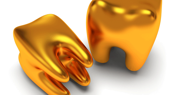 Goldbeißer lassen nicht nur Frauenherzen höherschlagen