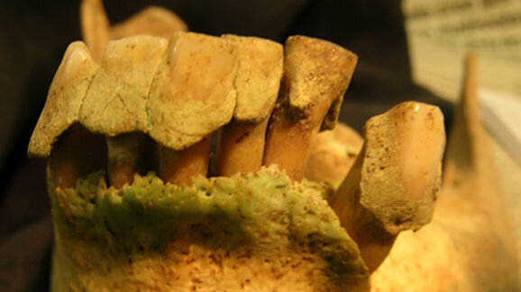 Researchers examine ancient diets using dental plaque