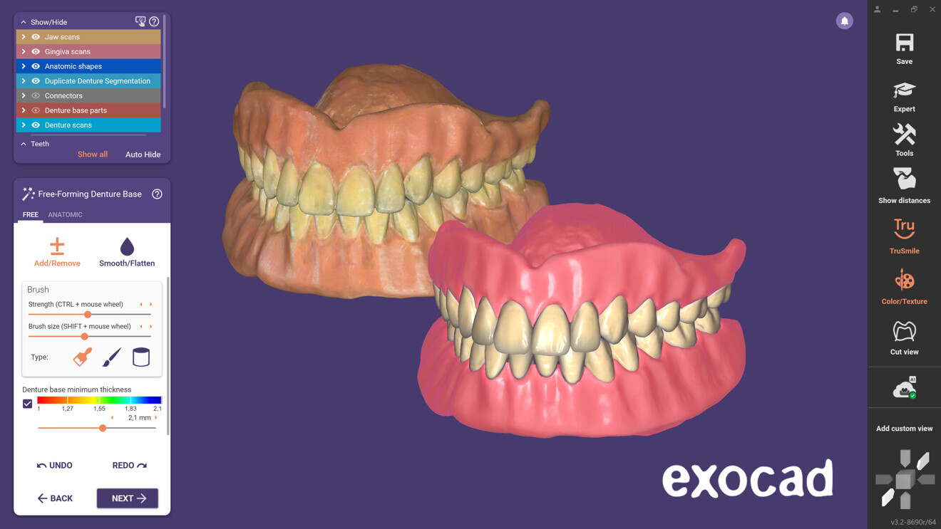 The Full Denture module includes a new feature to rapidly copy an existing denture in a highly automated workflow.
