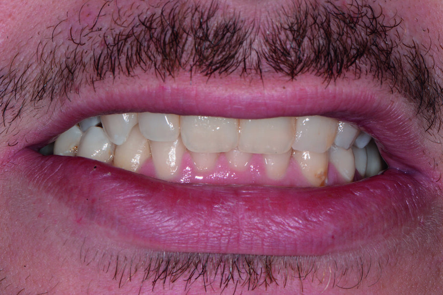 Fig. 1a