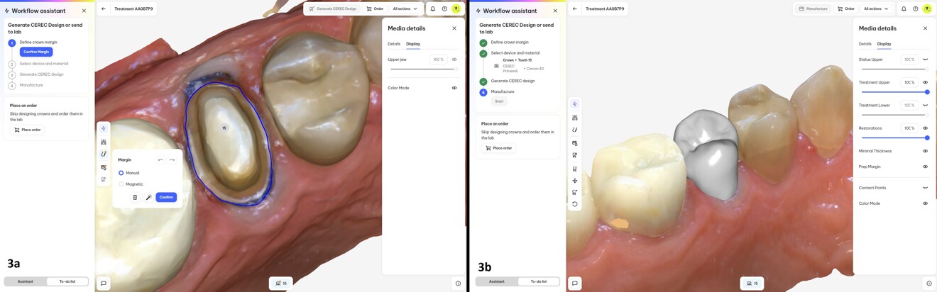 Figs. 3a & b: Automatic preparation margin (c) and CEREC crown proposal (b) on DS Core.