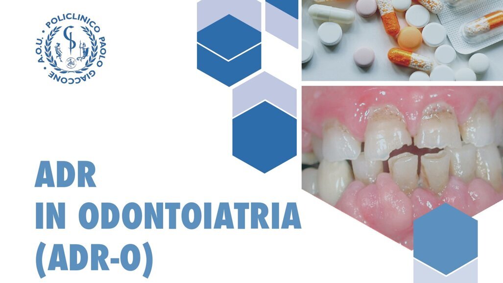 Al Lingotto di Torino il primo Workshop Nazionale dal titolo “ADR IN ODONTOIATRIA, reazioni avverse a farmaci: stato dell’arte e prospettive”