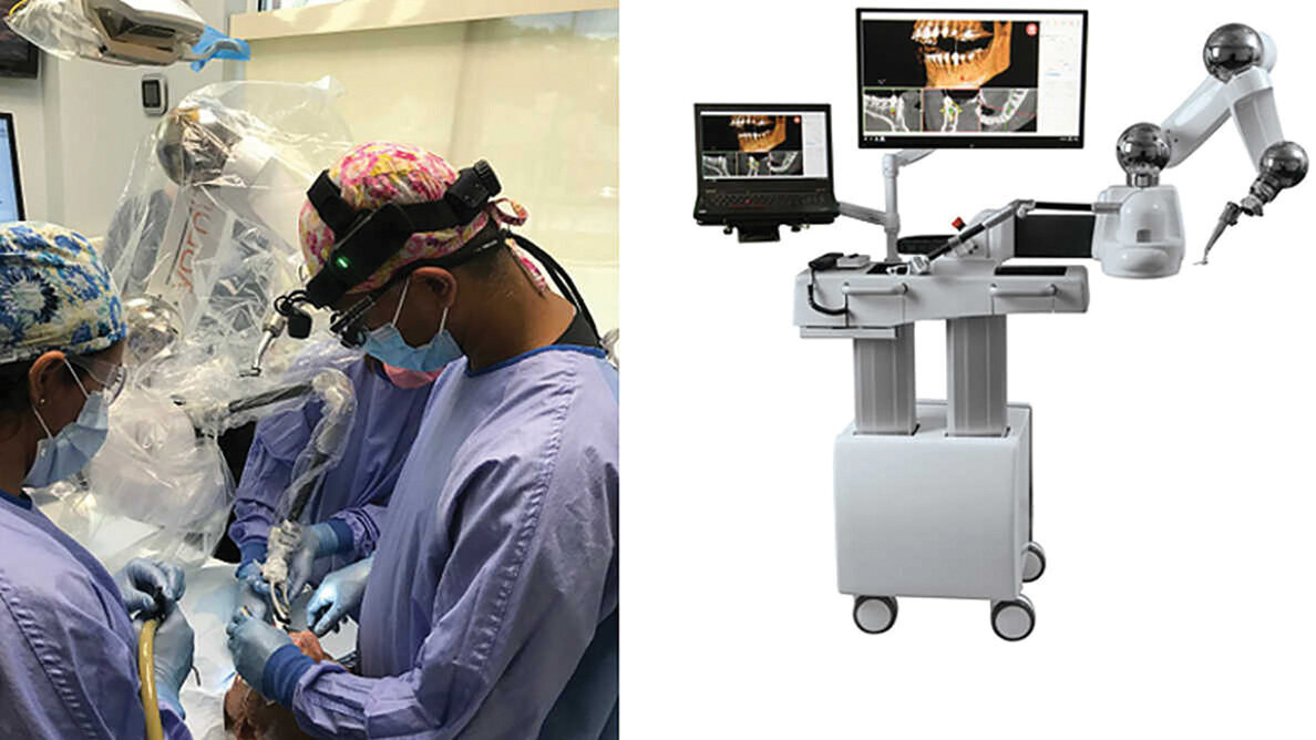 Periodontist becomes one of first to use surgical robotics when placing implants