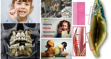 Los dientes, guardianes silenciosos de nuestra salud