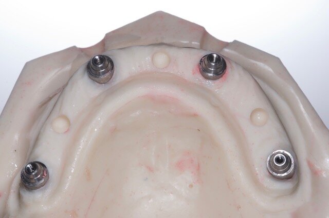 Fig. 30